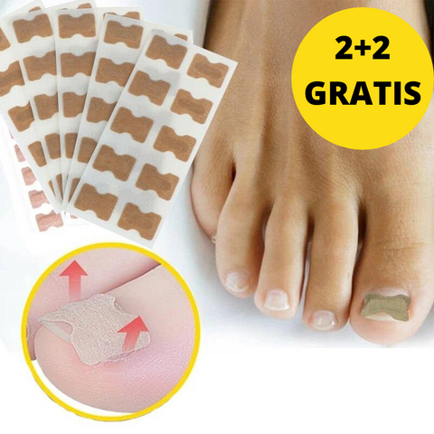 Nail-Anti inngrodde klistremerker | 2 + 2 gratis